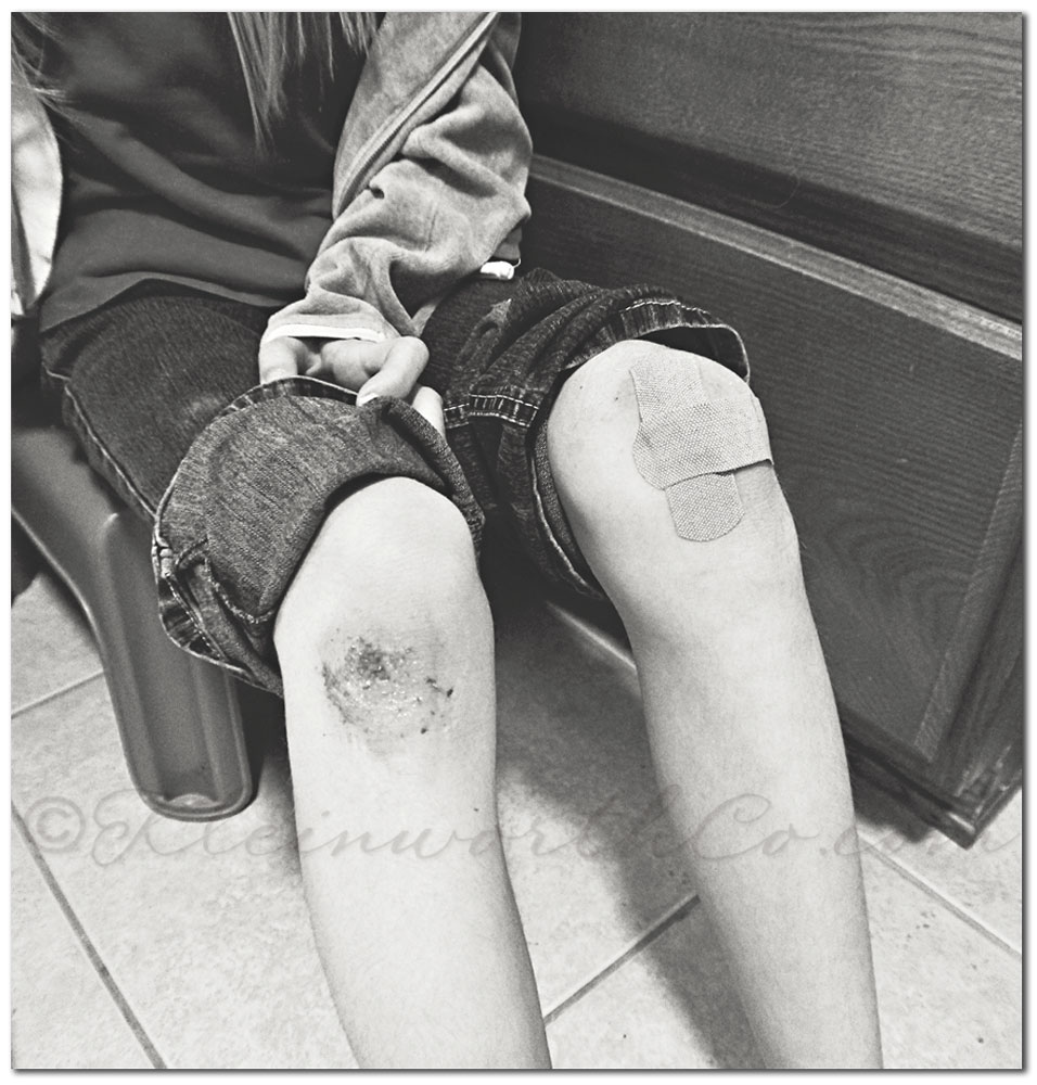 Skinned Knees & SafeSkin Kids Skinned Knees & SafeSkin Kids